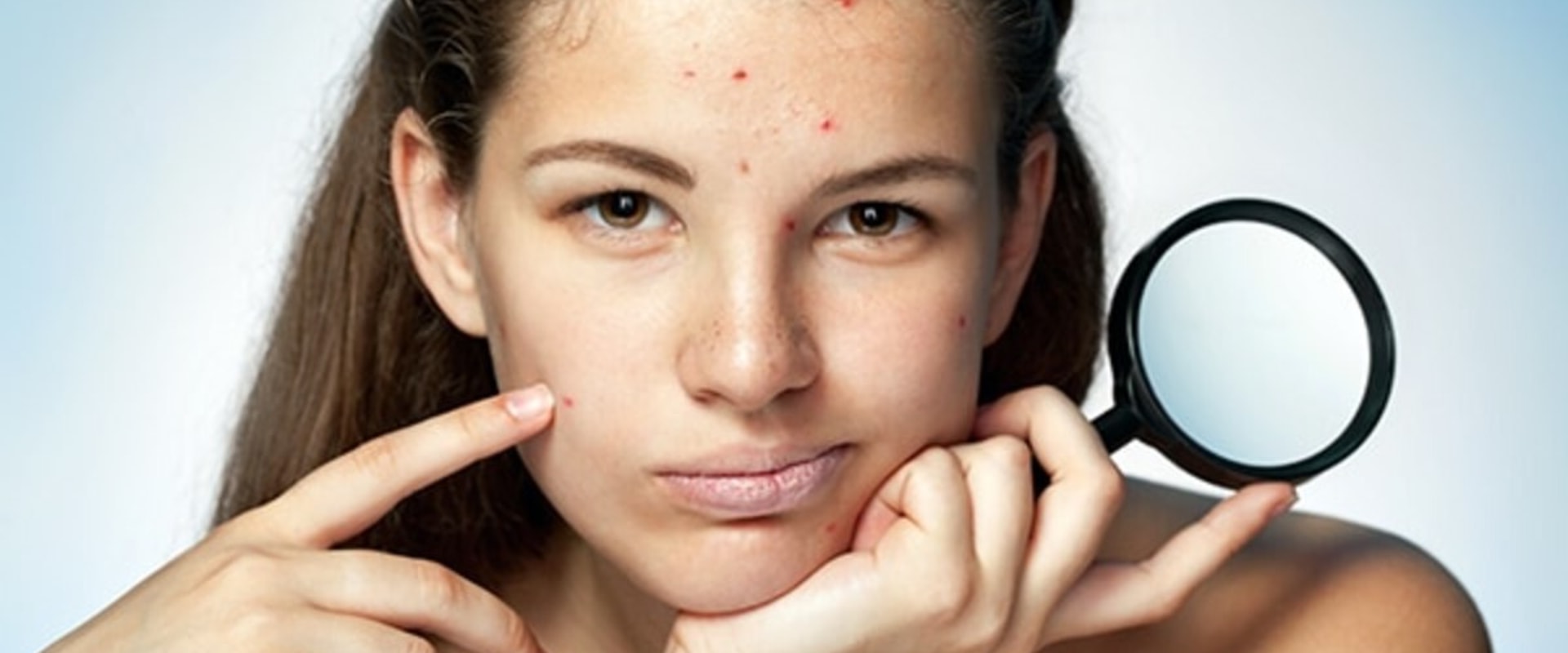 Acne Facials: A Comprehensive Guide